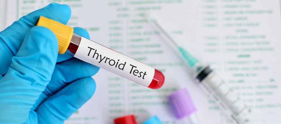 Here’s More on When to go for a Thyroid Test