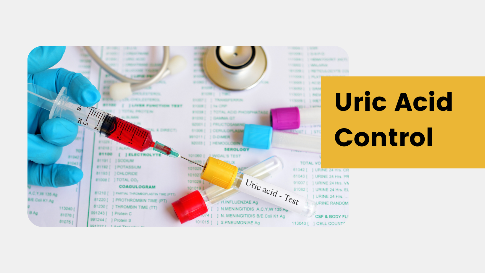 Uric Acid control
